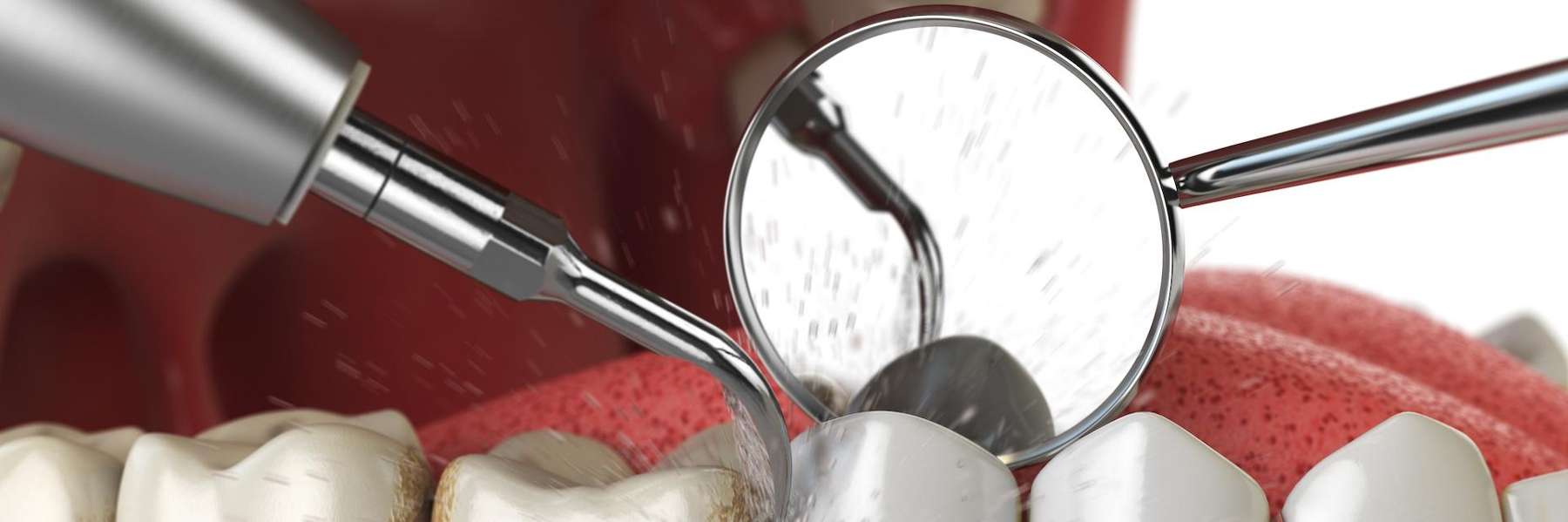dental cleaning for your family