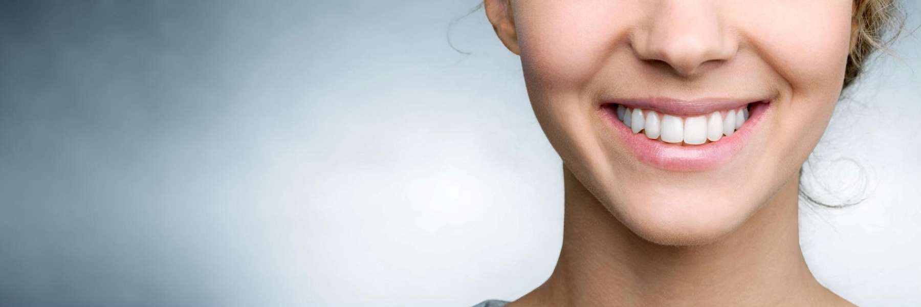 Veneers | Dentist