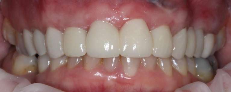 Case-4-After-Image