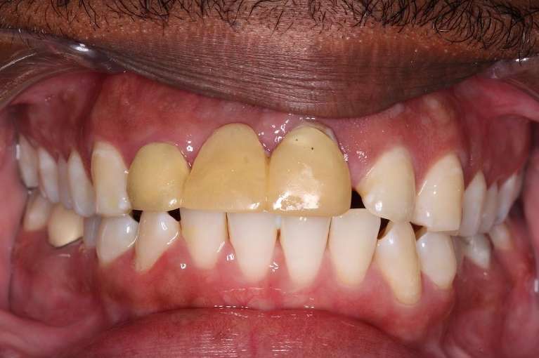 Case-2-Before-Image
