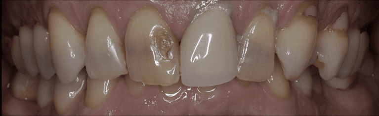 Smile-Makeover-Before-Image