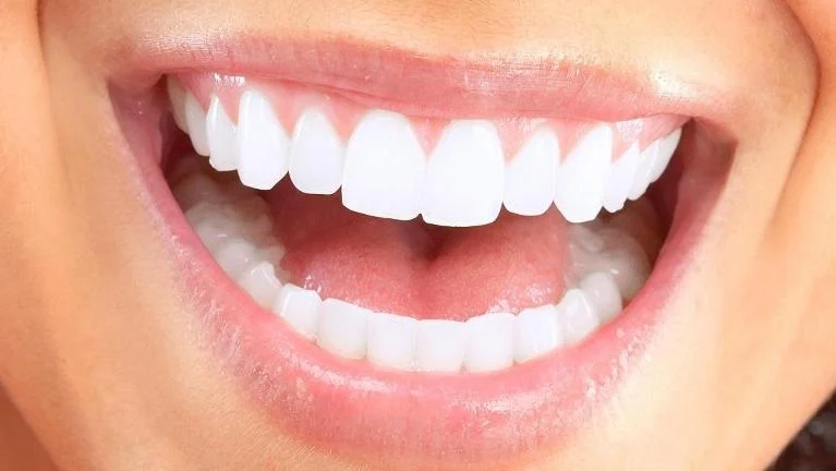 Five Tips For Avoiding Cavities